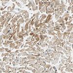 Nestin Antibody in Immunohistochemistry (Paraffin) (IHC (P))