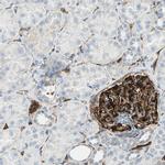 Nestin Antibody in Immunohistochemistry (Paraffin) (IHC (P))