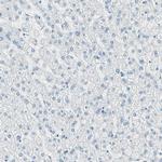 Nestin Antibody in Immunohistochemistry (Paraffin) (IHC (P))