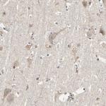 MLK2 Antibody in Immunohistochemistry (Paraffin) (IHC (P))