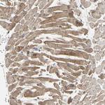 MLK2 Antibody in Immunohistochemistry (Paraffin) (IHC (P))