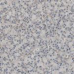 MLK2 Antibody in Immunohistochemistry (Paraffin) (IHC (P))