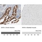 KHK Antibody