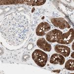 KHK Antibody in Immunohistochemistry (Paraffin) (IHC (P))