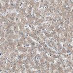 KHK Antibody in Immunohistochemistry (Paraffin) (IHC (P))