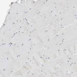 KHK Antibody in Immunohistochemistry (Paraffin) (IHC (P))