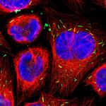 MST2 Antibody in Immunocytochemistry (ICC/IF)