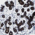 MST2 Antibody in Immunohistochemistry (Paraffin) (IHC (P))