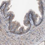 CD81 Antibody in Immunohistochemistry (Paraffin) (IHC (P))