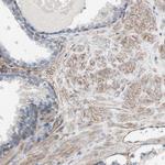 CD81 Antibody in Immunohistochemistry (Paraffin) (IHC (P))