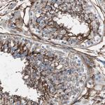 CD81 Antibody in Immunohistochemistry (Paraffin) (IHC (P))