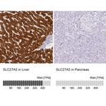 SLC27A5 Antibody