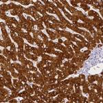 SLC27A5 Antibody in Immunohistochemistry (Paraffin) (IHC (P))