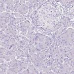 SLC27A5 Antibody in Immunohistochemistry (Paraffin) (IHC (P))