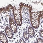 NQO1 Antibody in Immunohistochemistry (Paraffin) (IHC (P))