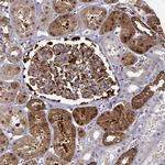 NQO1 Antibody in Immunohistochemistry (Paraffin) (IHC (P))