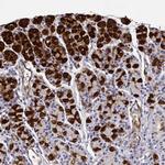 NQO1 Antibody in Immunohistochemistry (Paraffin) (IHC (P))