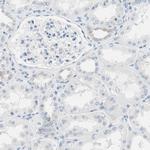 Glutamine Synthetase Antibody in Immunohistochemistry (Paraffin) (IHC (P))