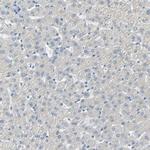 Podoplanin Antibody in Immunohistochemistry (Paraffin) (IHC (P))