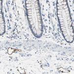 Podoplanin Antibody in Immunohistochemistry (Paraffin) (IHC (P))