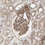 ROCK1 Antibody in Immunohistochemistry (Paraffin) (IHC (P))