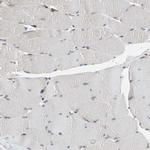 ROCK1 Antibody in Immunohistochemistry (Paraffin) (IHC (P))