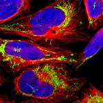 ACAT1 Antibody in Immunocytochemistry (ICC/IF)