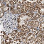 ACAT1 Antibody in Immunohistochemistry (Paraffin) (IHC (P))