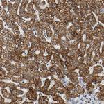 ACAT1 Antibody in Immunohistochemistry (Paraffin) (IHC (P))