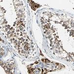 ACAT1 Antibody in Immunohistochemistry (Paraffin) (IHC (P))