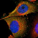 FER Antibody in Immunocytochemistry (ICC/IF)