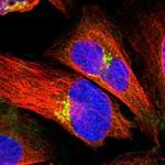 PDE8A Antibody in Immunocytochemistry (ICC/IF)