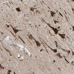 PDE8A Antibody in Immunohistochemistry (Paraffin) (IHC (P))