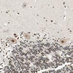 CDK7 Antibody in Immunohistochemistry (Paraffin) (IHC (P))