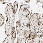 CDK7 Antibody in Immunohistochemistry (Paraffin) (IHC (P))