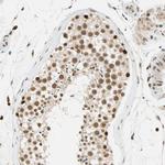 CDK7 Antibody in Immunohistochemistry (Paraffin) (IHC (P))