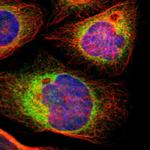 RAP Antibody in Immunocytochemistry (ICC/IF)