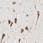 RAP Antibody in Immunohistochemistry (Paraffin) (IHC (P))