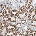 RAP Antibody in Immunohistochemistry (Paraffin) (IHC (P))