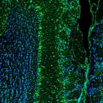 RAP Antibody in Immunohistochemistry (Paraffin) (IHC (P))