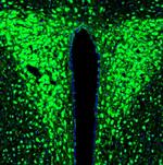 RAP Antibody in Immunohistochemistry (Paraffin) (IHC (P))