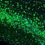 RAP Antibody in Immunohistochemistry (Paraffin) (IHC (P))