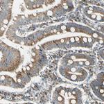 BNIP1 Antibody in Immunohistochemistry (Paraffin) (IHC (P))