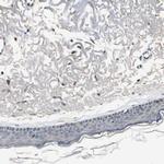 BNIP1 Antibody in Immunohistochemistry (Paraffin) (IHC (P))