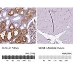 CLIC4 Antibody