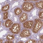 CLIC4 Antibody in Immunohistochemistry (Paraffin) (IHC (P))