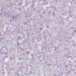 CLIC4 Antibody in Immunohistochemistry (Paraffin) (IHC (P))