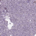 CLIC4 Antibody in Immunohistochemistry (Paraffin) (IHC (P))