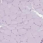 CLIC4 Antibody in Immunohistochemistry (Paraffin) (IHC (P))