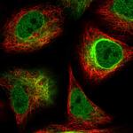 alpha Internexin Antibody in Immunocytochemistry (ICC/IF)